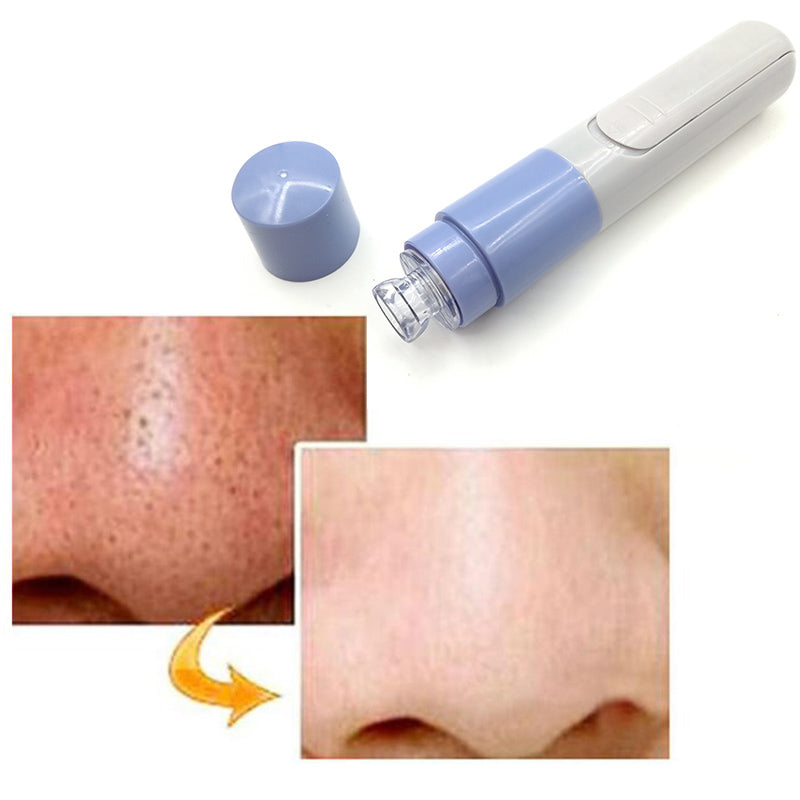 Electric Facial Pore Cleanser Skin Cleaner blackhead remover - Gadproshop