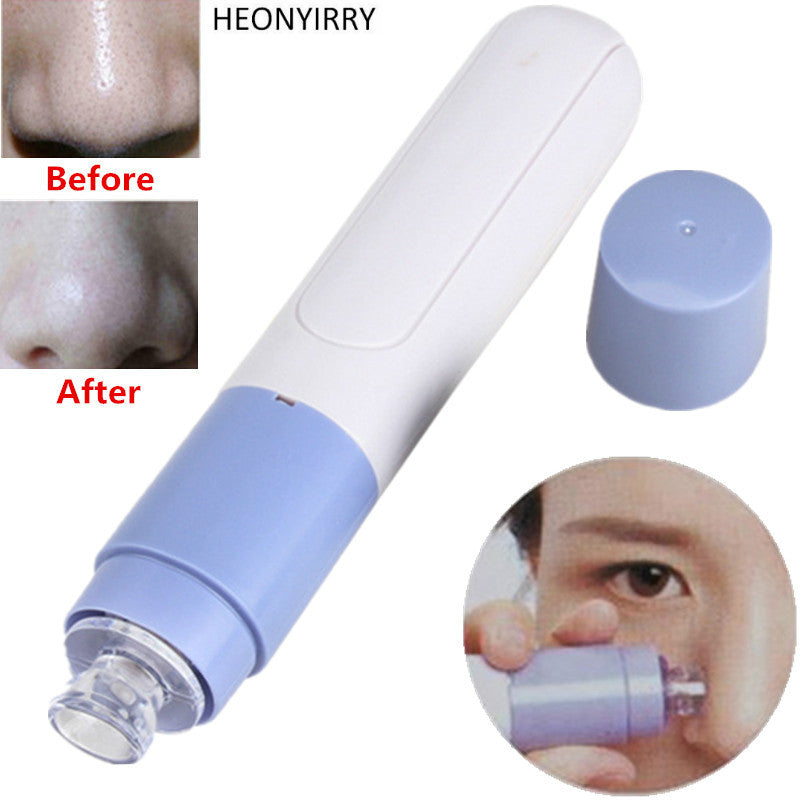 Electric Facial Pore Cleanser Skin Cleaner blackhead remover - Gadproshop